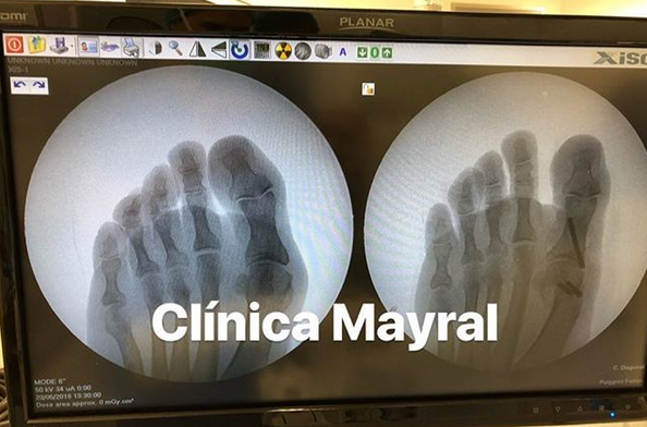 Fluoroscopio-Clinica-Mayral